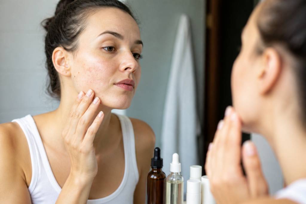 CBD et peau : le cannabidiol peut-il aider contre l’acné, l’eczéma et les irritations cutanées ?